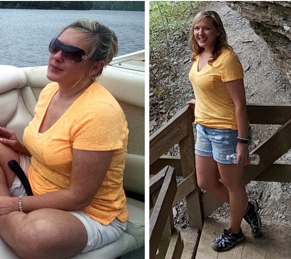Before and After Weight Loss on a Low Carb Diet