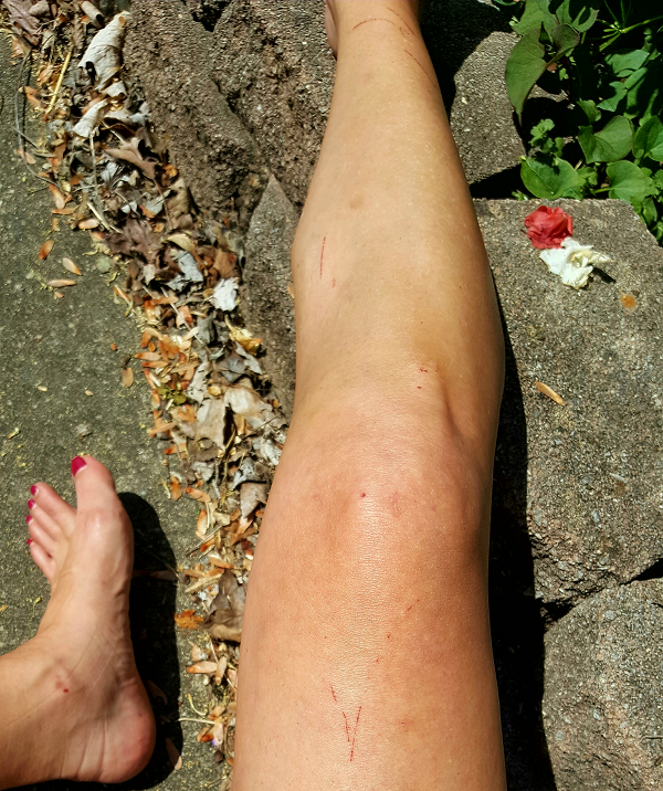 Outdoor Fitness Adventures = Scrapes & Bruises!